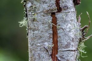 Liquen Escleroso Vulvar