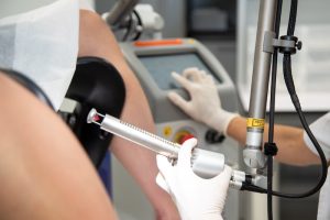reducción de labios menores con láser CO2